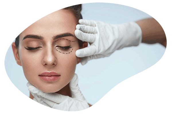 blefaroplastikh
