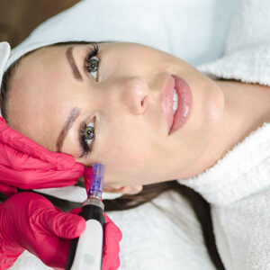dermapen