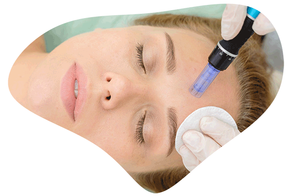 dermapen