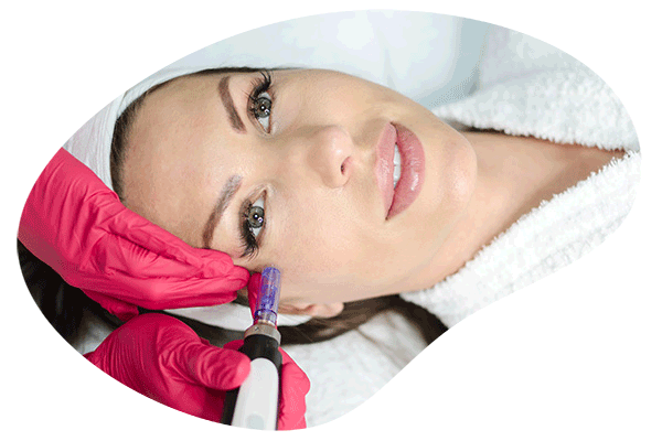 dermapen