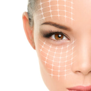face lift
